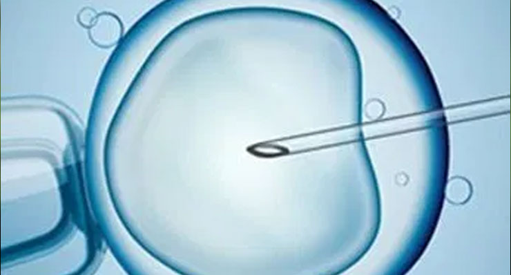 Assisted Reproductive Treatments